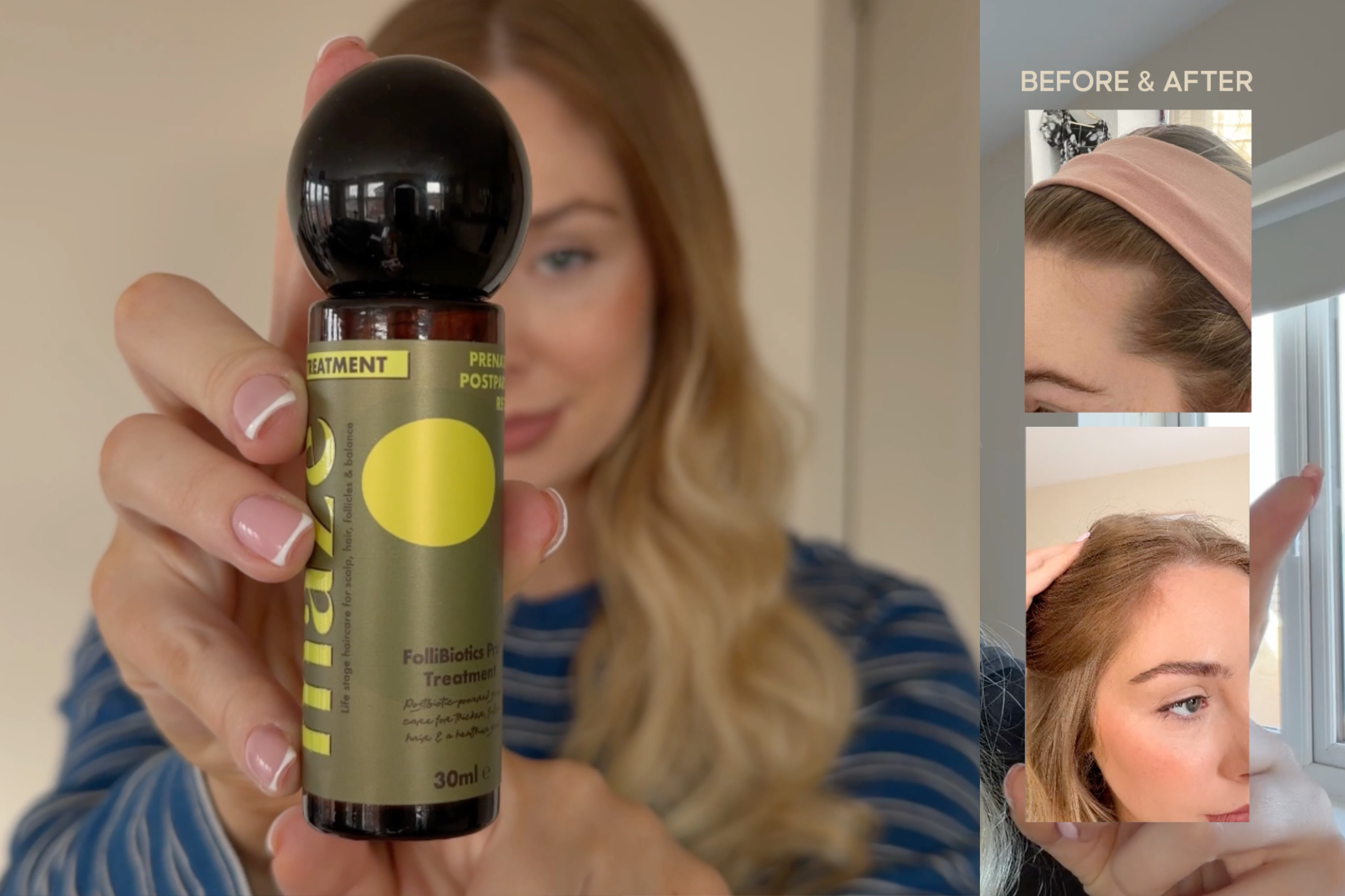 Follibiotics Pro™: The Postbiotic Inspired by Scalp Microneedling
